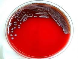 YERSINIA SELECTIVE AGAR